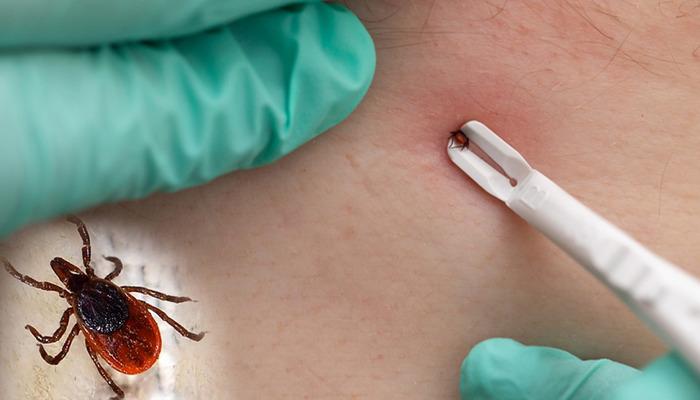 30 Tür Çek! Bu türler birçok farklı hastalık virüsünü taşır! Uzmanlar uyarıyor …