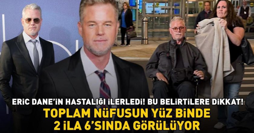 Euphoria’nın yıldızı Eric Dane hastalığı ilerledi! Bu belirtilere dikkat edin! Toplam nüfusun 100 bin başına 2-6’da görülür